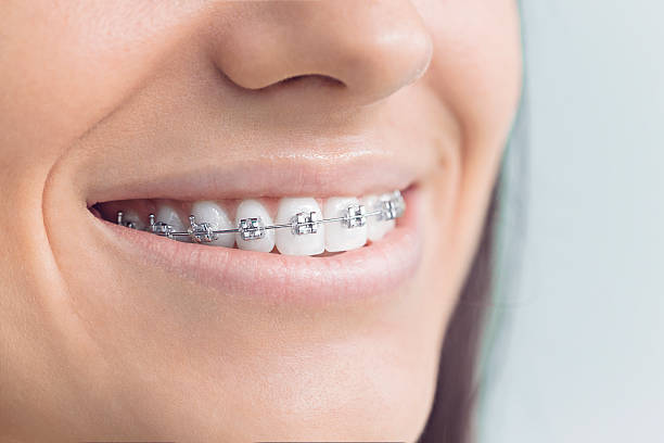 Best Invisalign and Clear Aligners  in Earlington, KY